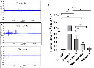 Rosmarinus officinalis essential oil triggers depression followed by CNS excitability in Wistar rats